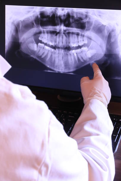 Best Emergency Wisdom Teeth Removal in Clancy, MT